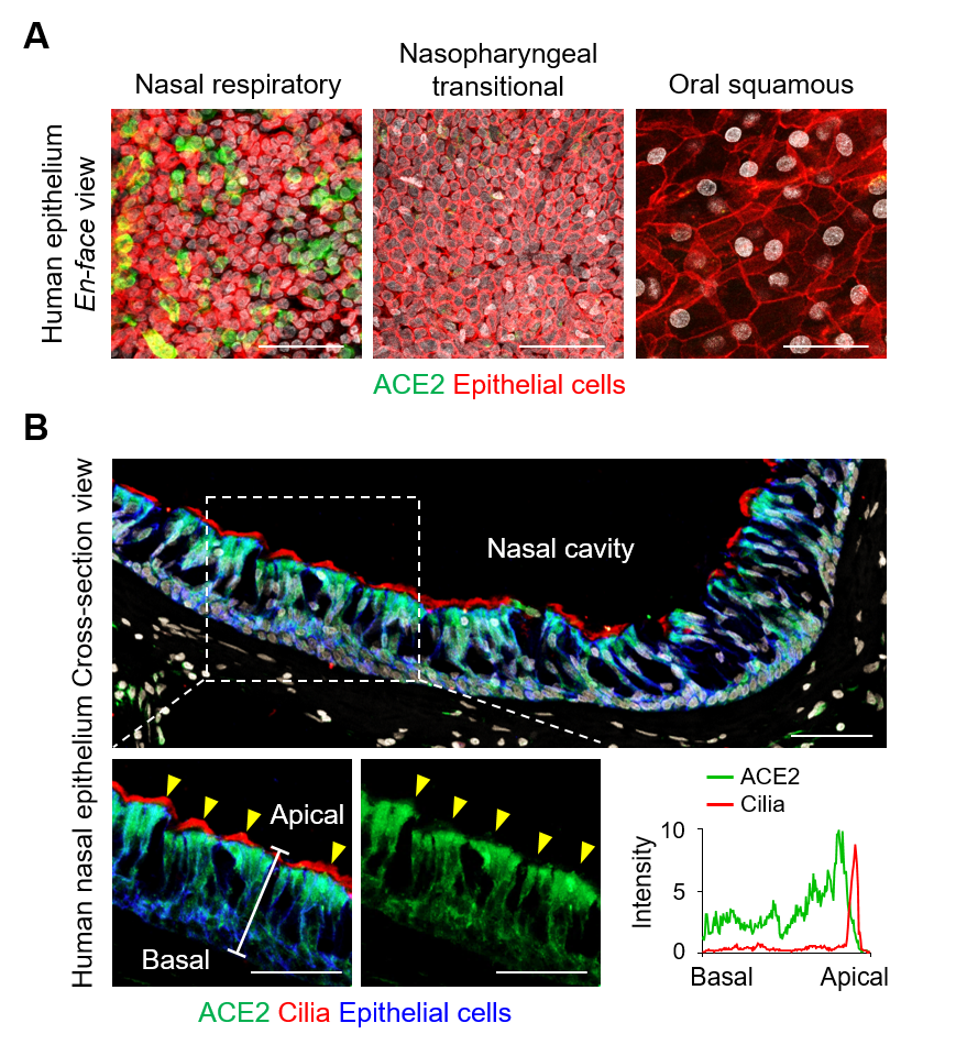 (A) en-face view of ACE2 protein signal in human nasal respiratory, nasopharynx transitional, and oral squamous epitheliums. Scale bars, 50 µm. (B) Cross-sectional view of human nasal epithelium showing robust ACE2 protein in acetylated--tubulin+ ciliated epithelium (yellow arrowheads). Box region of upper panel is highlighted in lower panels. Scale bars, 50 µm. Profile analysis of relative ACE2 signal intensity along the white line. Note that ACE2 protein is higher in apical side than basal side, while it is not present at motile cilia.