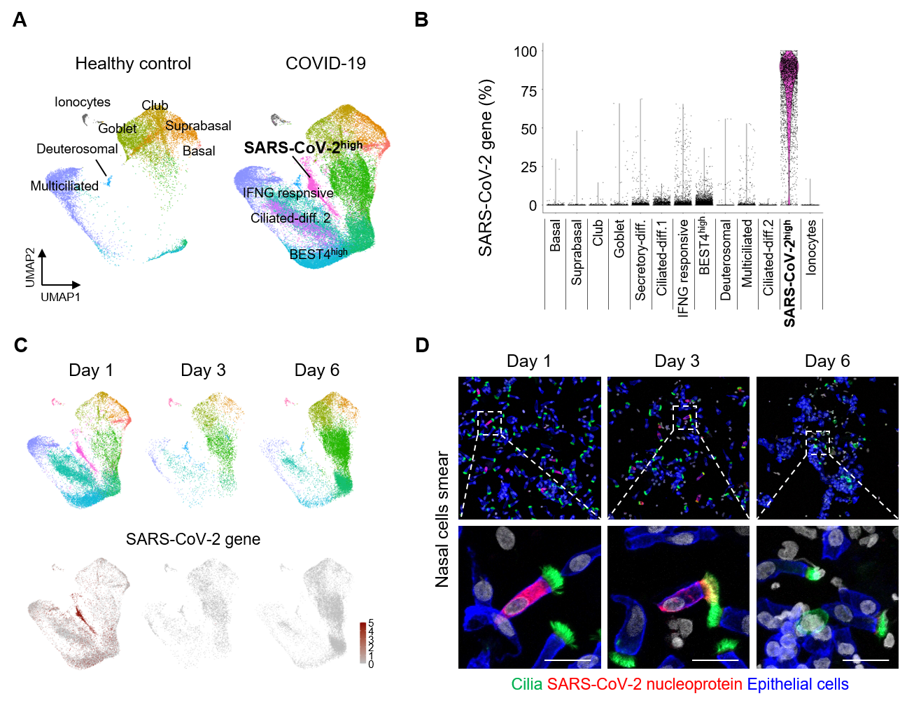 (A) UMAP plot comparing unsupervised clustering of nasal epithelial cell subsets between healthy controls and COVID-19 patients. (B) Comparison of proportion of SARS-CoV-2 genes in total detected genes per cell in each cluster. (C) UMAP plots showing changes in populations of the nasal epithelial cell clusters of mild COVID-19 patients on indicated day of hospitalization. (D) A rapid reduction of SARS-CoV-2 NP+ multiciliated cells during the hospitalization in COVID-19 patients. Dashed box regions are magnified in lower panels or insets. Scale bars, 20 µm and 200 µm.