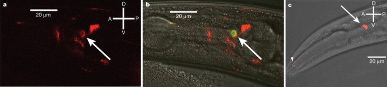 예쁜꼬마선충에서 TMC-1 수용체가 활성화된 모습(화살표). 2013년 황선욱 고려대 의대 교수팀은 나트륨(소금)이 증가했을 때 TMC-1이 활성화돼 소금을 회피하는 방향으로 움직인다는 사실을 발견했다.(출처: Nature)