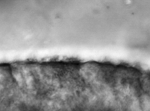 인간 비강유래 상피전구세포로부터 분화 유도된 섬모세포의 섬모운동