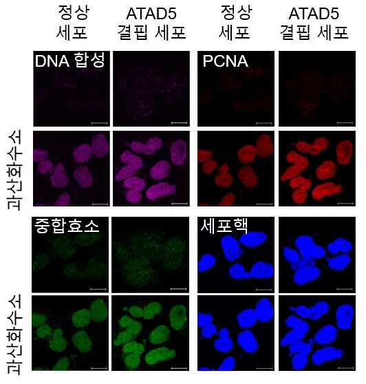 [그림1] 활성산소에 의한 복구 DNA 합성은 ATAD5 단백질 결핍 시 늘어난다. 이미지로서 자세한 내용은 하단에 위치해 있습니다.