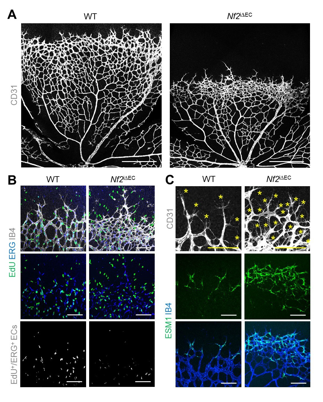 Figure 2. The changes of retinal vessels at postnatal day 6 after depletion of Merlin in ECs