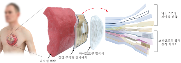 [그림1] 심장 부착형 패치형 디바이스 플랫폼 설계
            Active-matrix 매트릭스 압력 감지 트랜지스터 어레이 및 생체 적합성 페이싱으로 구성된 장치 플랫폼의 도식 레이아웃.