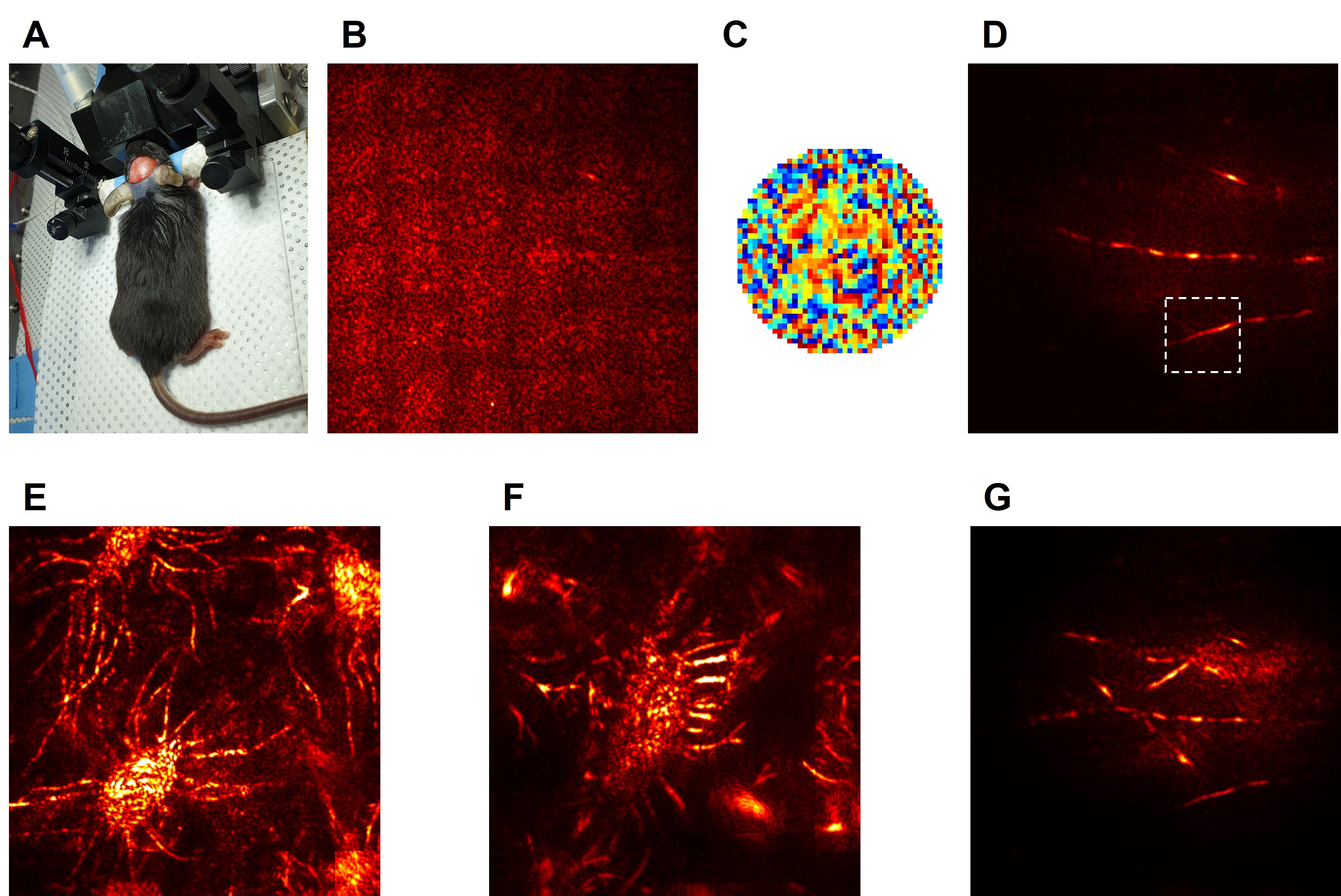 Figure 3. A neural network in the brain of a living mouse was observed without removing the skull