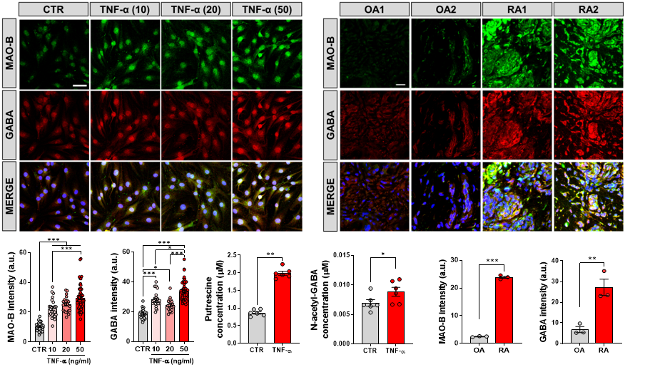 Figure 1. MAO-B and GABA were found to be present in the joint fibroblast-like synoviocytes cells (FLSs), and the expression of MAO-B and GABA was associated with the degree of inflammation.
            