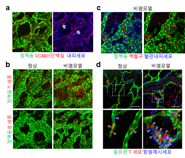 ▲ 비강 내 정맥동과 비전형적 림프관의 면역반응에 대한 특수화
            정맥동 혈관에서 VCAM1이라는 면역세포의 이동에 중요한 단백질이 특이적으로 발현하고 있는 것을 시각화하였고(그림 a), 생쥐 비염모델에서 정맥동 및 비강 내에 면역세포들이 증가함(그림 b). 비염모델에서 면역세포들이 주로 정맥동 혈관에 특이적으로 결합하여 비강내로 유입됨(그림 c), 비전형적인 림프관 내에는 정상에서보다 많은 수의 다양한 면역세포들이 들어가 이동함(그림 d). 이러한 과정을 통해 정맥동 혈관과 비전형적 림프관이 외부에서 침입하는 병원균에 대하여 면역반응을 잘 할 수 있도록 특수화 되어 있다는 것을 발견함. 