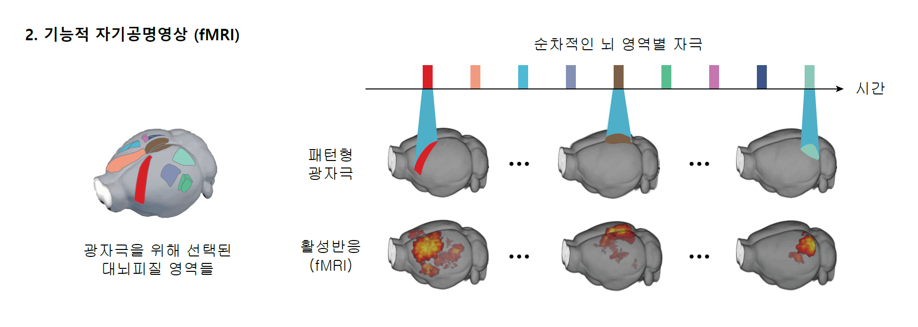 [그림3] 기능적 자기공명영상(fMRI)
            이번 연구에서는 총 9개의 영역이 목표로 설정되었다, 이 9개의 영역이 순차적으로 자극되고, 이에 대한 반응은 fMRI로 측정된다.