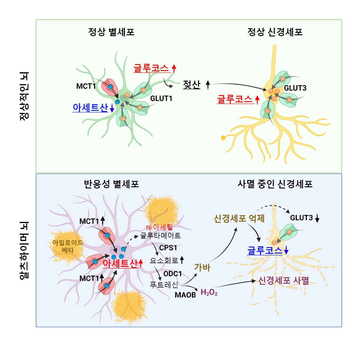 [그림 5] 알츠하이머에서 아세트산의 이상 과다흡수를 통해 촉진되는 반응성 별세포화와 이에 의한 신경세포 대사 및 기능 저하 기전