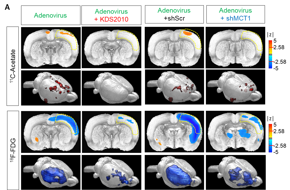 Figure 2. 11C-acetate and 18F-FDG in vivo micro-PET imaging in adenovirus model (reactive astrogliosis model).