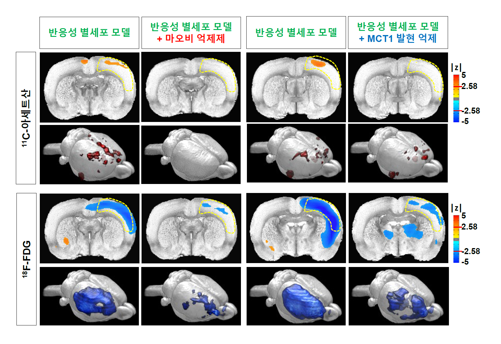 ▲ 반응성 별세포 동물 모델에서 PET 영상 촬영을 통해 관찰되는 11C-아세트산 흡수 증가와 18F-FDG 흡수 감소