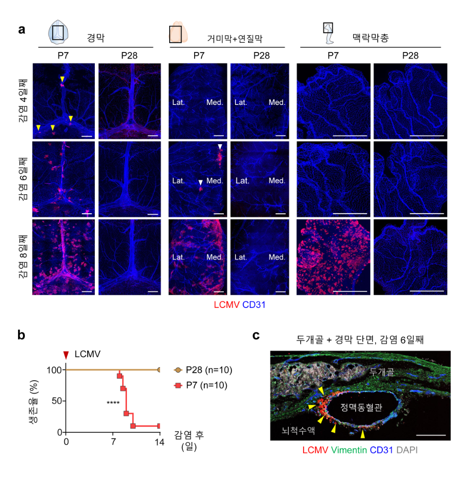 [그림 1] 생쥐 연령별 뇌수막염 바이러스 감염 모델 면역반응의 차이