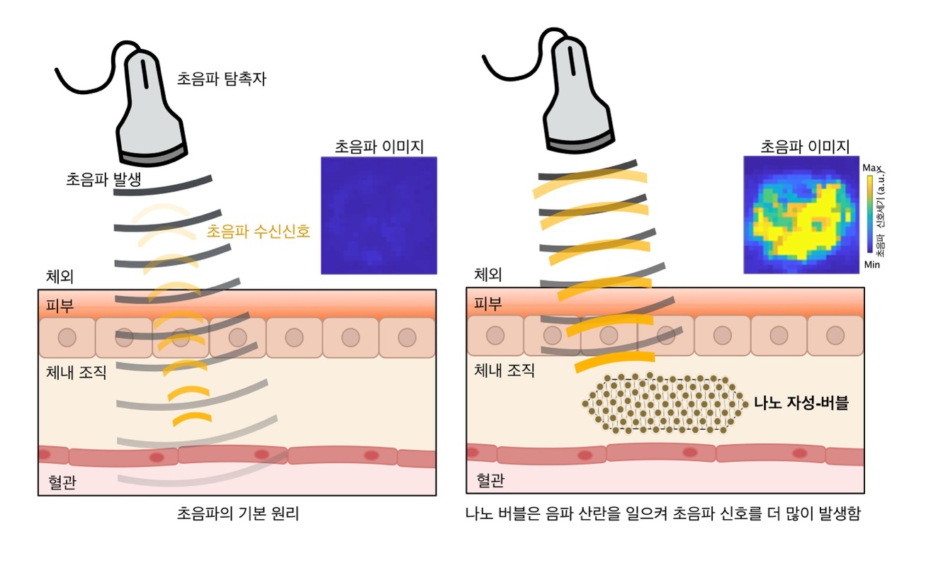 [그림2] 나노 자성-버블 초음파 영상의 원리
            초음파의 기본 원리는 음파가 조직을 통과하면서 여러 조직 층을 만나며 반사/산란/굴절되는 신호를 읽는 것으로, 이를 통해 초음파 영상이 생성된다. 특히 음파는 매질 간의 음파 저항차이가 크게 되면 음파의 산란이 더 크게 발생하여 초음파 신호가 더 많이 발생된다.