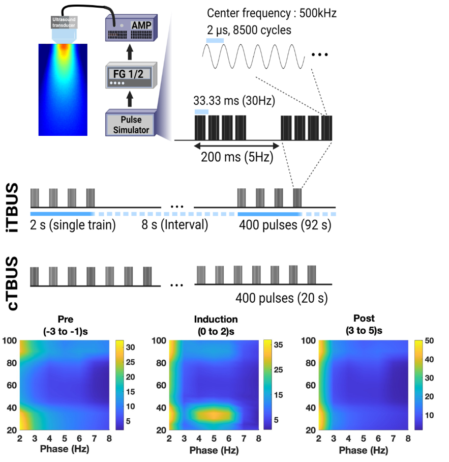 Figure 1. Ultrasound experimental parameters and synchronization of brain waves