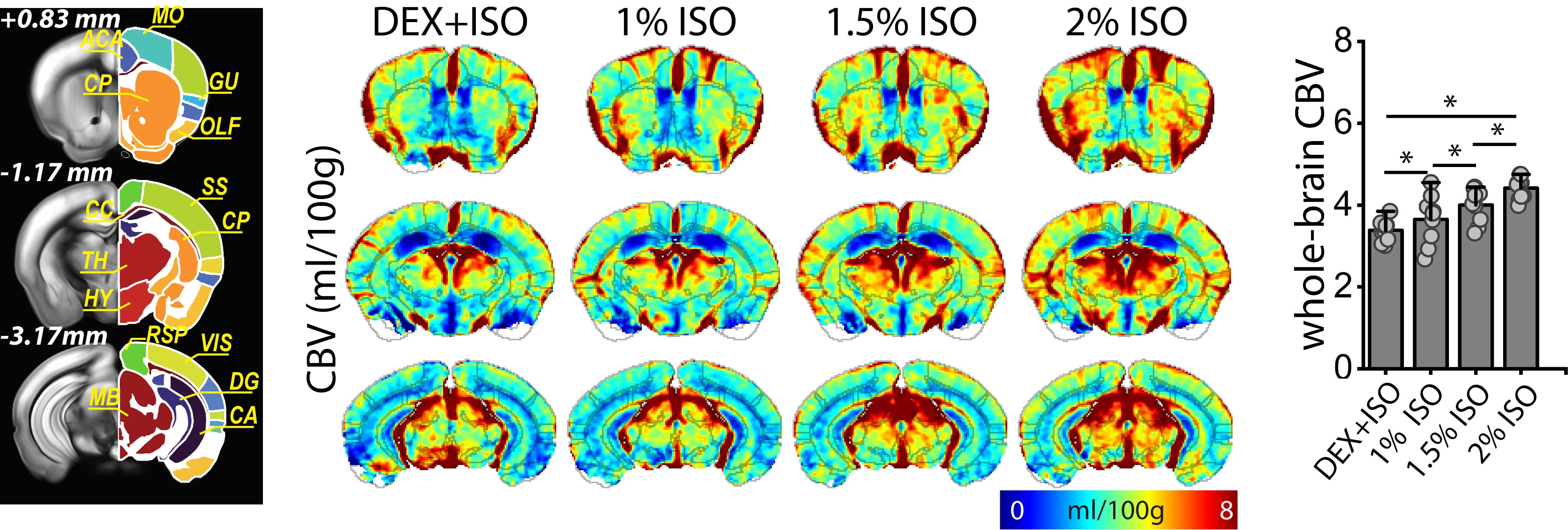 [그림 2] 덱스메데토미딘+아이소플루레인(0.3%), 아이소플루레인(1%, 1.5%, 2%) 등 4가지 마취 조건에서 뇌 혈류지표를 측정·계산해 쥐 MRI 뇌 영상에 맵핑한 영상과 수치 결과(그래프)