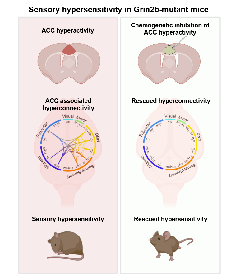 Figure 1. Sensory hypersensitivity in mice with the Grin2b gene mutation found in patients is related to hyperactivity of the anterior cingulate cortex (ACC) and hyperconnectivity between the ACC and other brain regions.