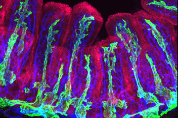 Newly identified gut cells nurture lymph capillaries
