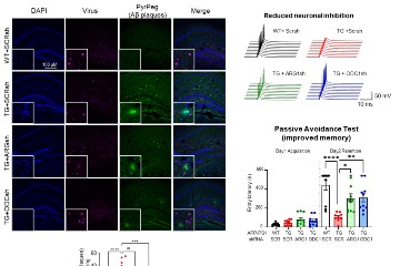 The astrocytic urea cycle in the brain controls memory impairment in Alzheimer’s Disease